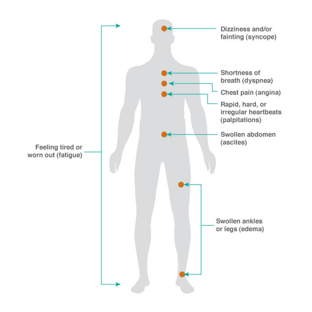 Common symptoms of PAH